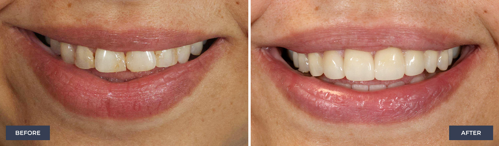 before and after image