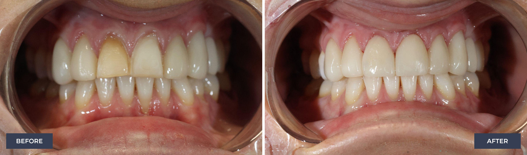 before and after image