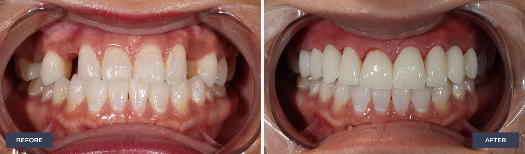 before and after image