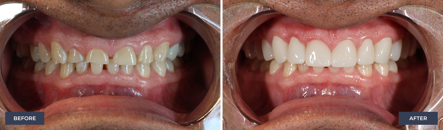 before and after image
