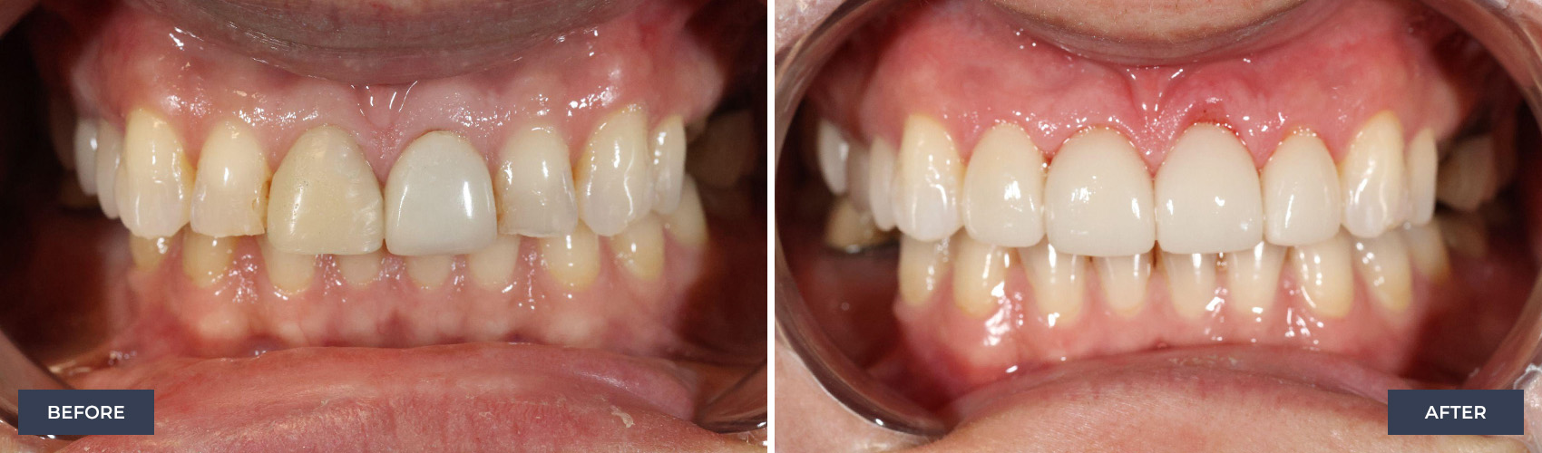 before and after image