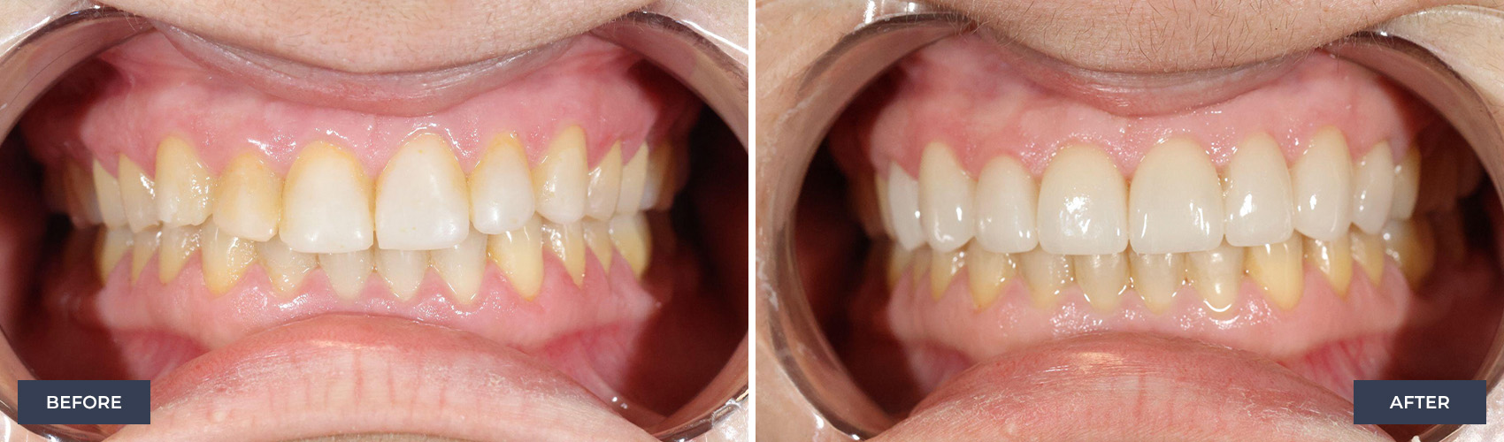 before and after image