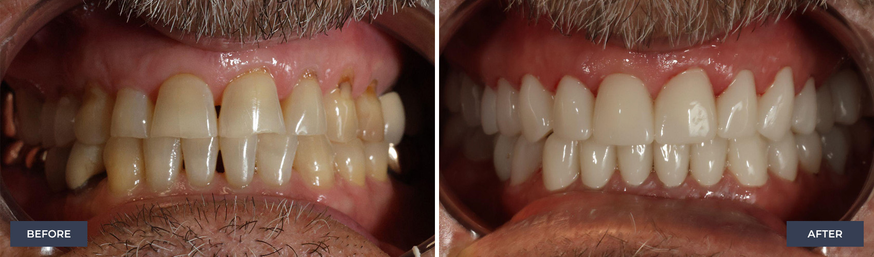 before and after image